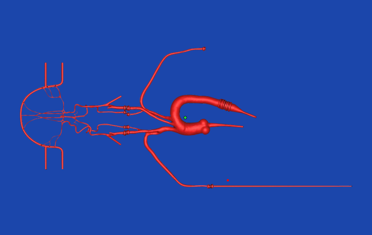 Neuro Vascular System XIX(SJ001D-019) Neuro Vascular System XIX(SJ001D-019)