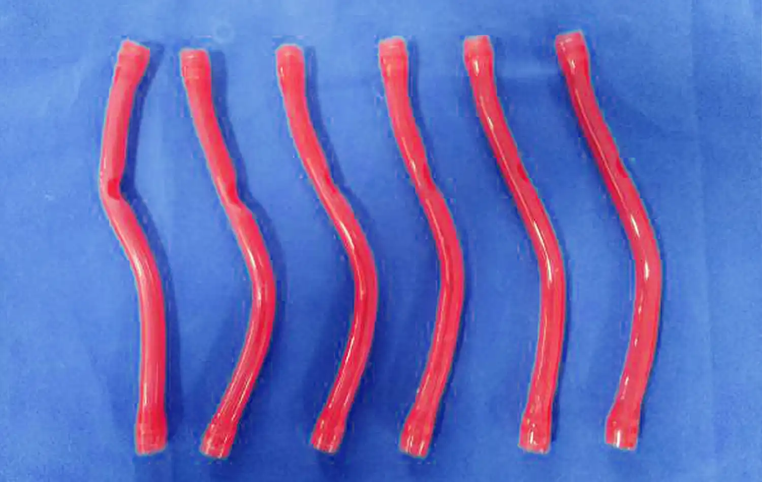 Stenosis replaceable vessel Stenosis replaceable vessel