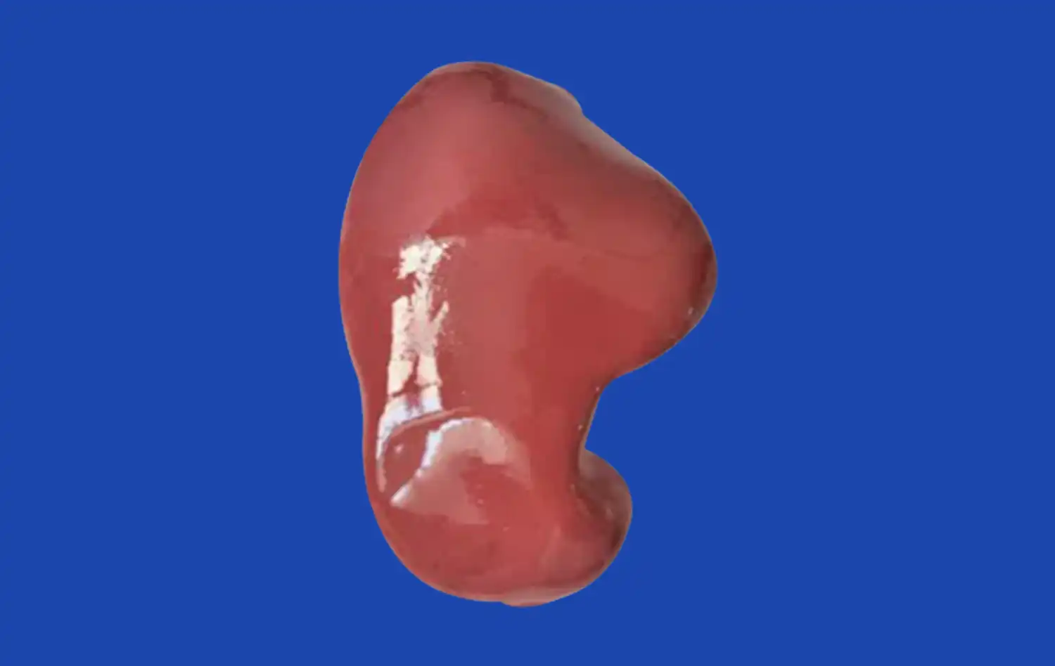 3D Kidney Model 3D Kidney Model